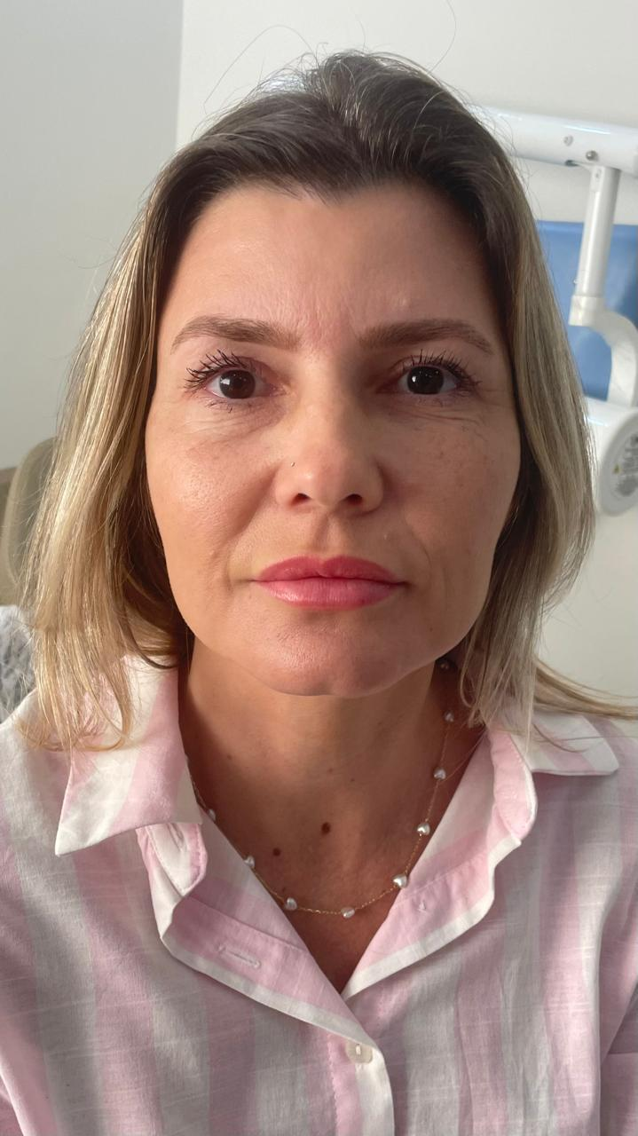 Caso 02 — depois