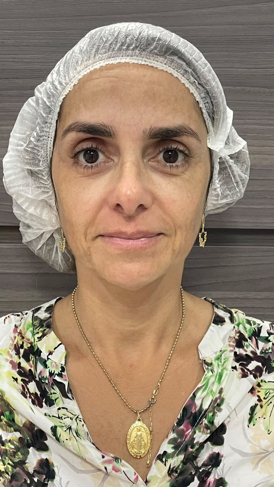 Caso 03 — antes